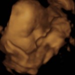 BABY _1