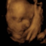 BABY _2