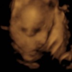 BABY _3