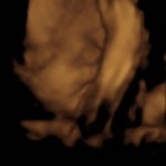 BABY _4
