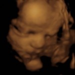 BABY _5