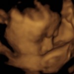 BABY _6