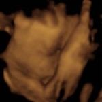 BABY _7