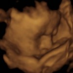 BABY _8