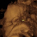 baby girl_1_1