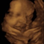 baby girl_1_2