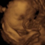 baby girl_1_3