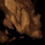 baby girl_1_4