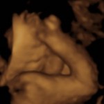 baby girl_2_6