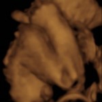 baby girl_2_7