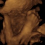baby girl_2_9